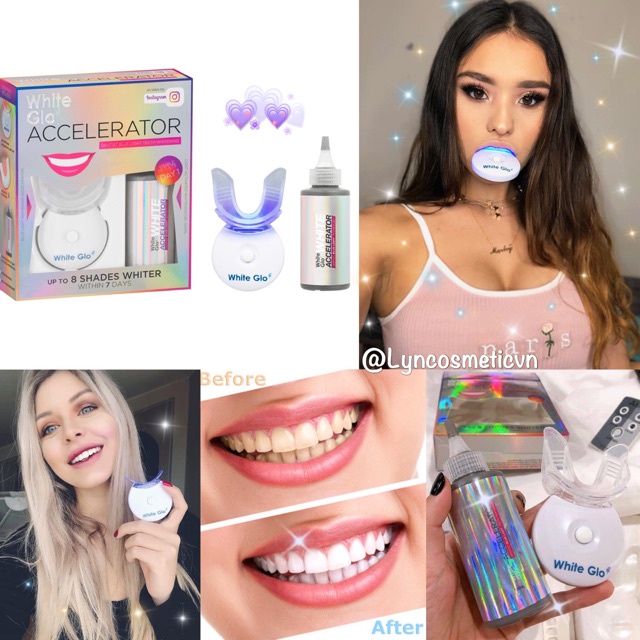 Bộ làm trắng răng White Glo White Accelerator Blue Light Teeth Whitening System