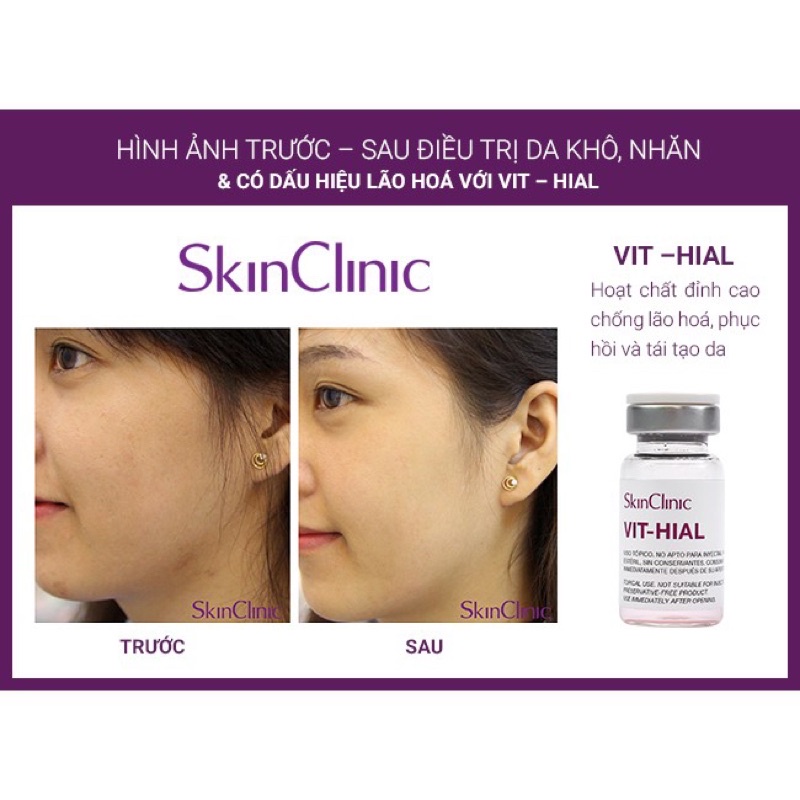 VIT-HIAL-sản phẩm chống lão hóa, phục hồi và tái tạo da cực kỳ hiệu quả 1 hộp 5 lọ