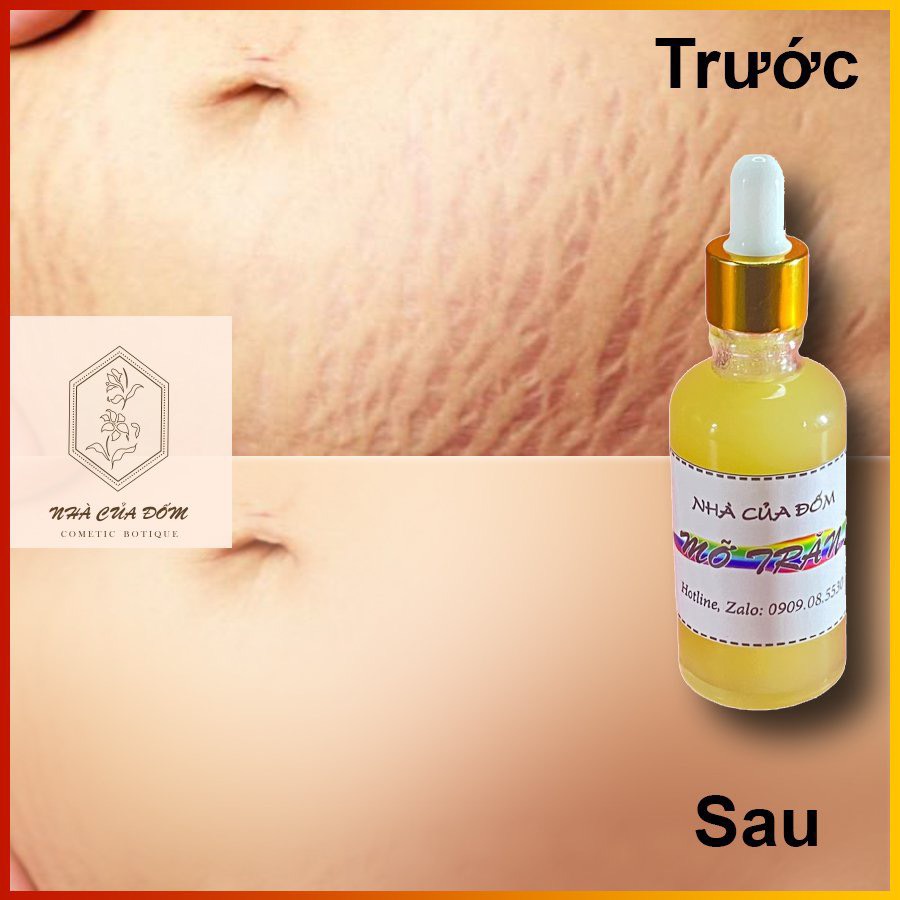 50ml MỠ TRĂN NGUYÊN CHẤT TRIỆT LÔNG