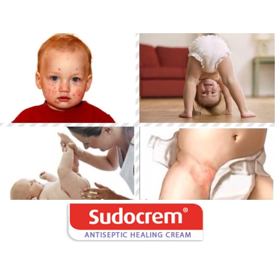 Kem Hăm Tã Sudocrem 60g Cho Trẻ Từ Sơ Sinh
