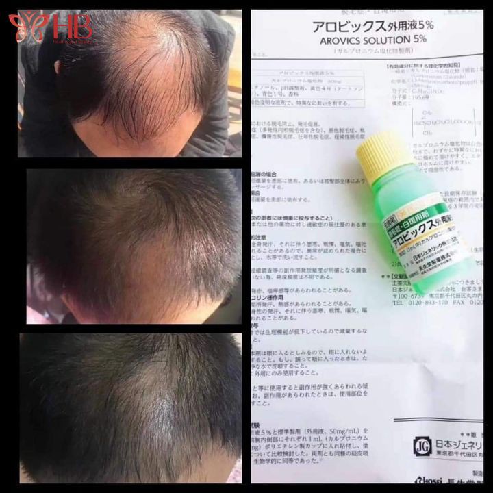 Tinh chất thảo dược kích thích mọc tóc SATO Nhật Bản 30ml