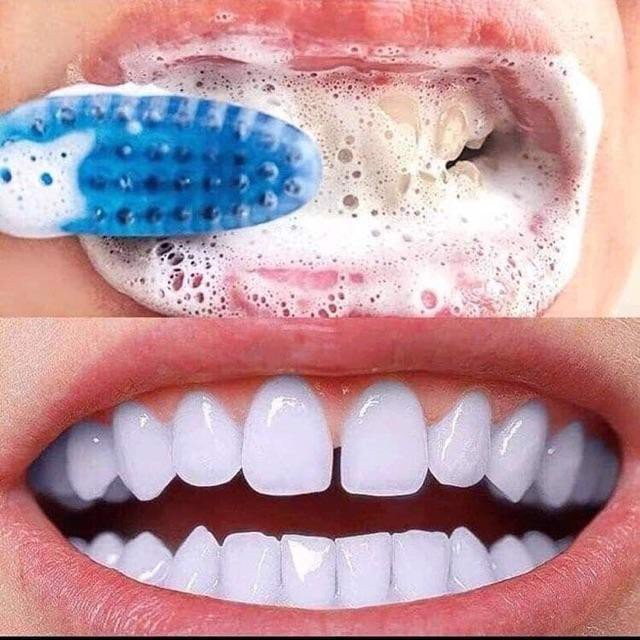 Kem đánh trắng răng Hàn Quốc Median Dental 93 màu đỏ hỗ trợ làm trắng răng đánh bay mảng bám trên răng