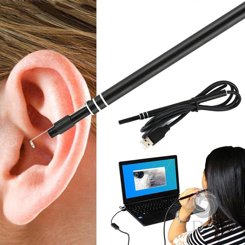 Bộ Lấy Ráy Tai Có Camera, Camera Nội Soi Tai, Mũi, Họng Siêu Nét Bảo Hành 12 Tháng