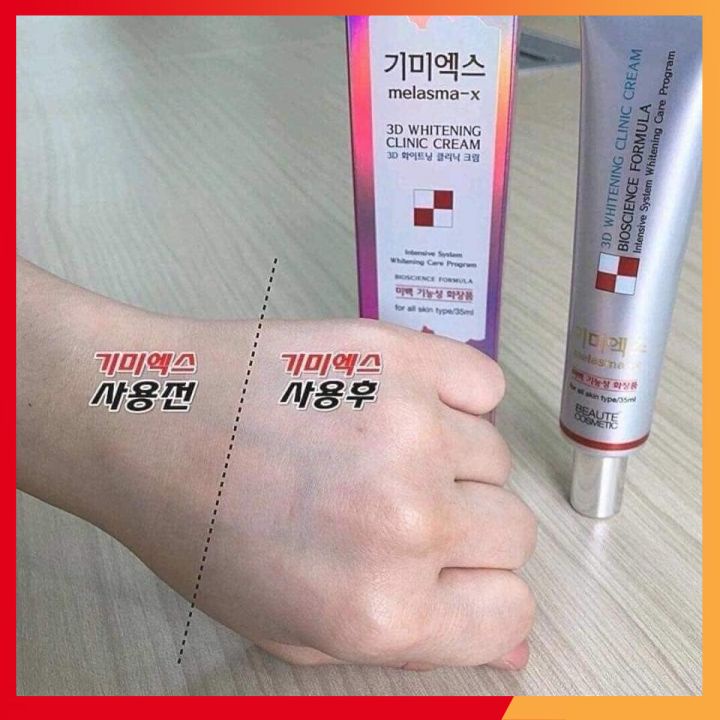 Kem nám 3D melasma 35ml, hỗ trợ làm trắng và làm mờ thâm nám tàn nhang