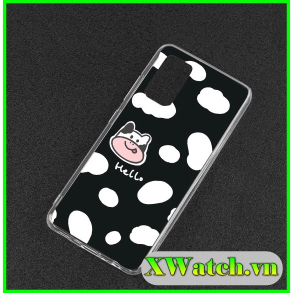 Ốp silicon in UV Bò sữa Xiaomi Redmi Note 10 Mi max Mi max 2 / Mi max 3 / Redmi 3s / Redmi 4a Redmi 4x Redmi 5a Note 4x