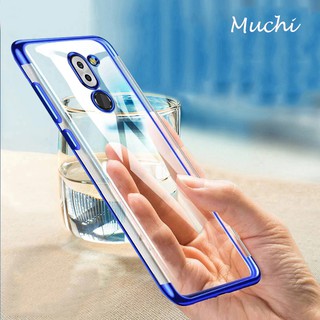 Ốp điện thoại dẻo mạ laser trong suốt thời trang dành cho Huawei Mate 20/20 Lite/20 Pro