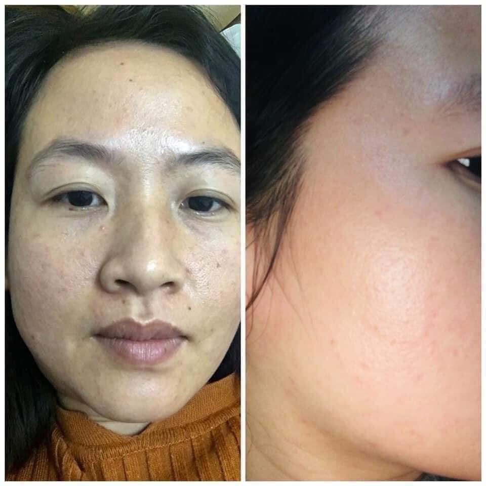 Bột Collagen Bena Gana - Hộp 30 gói nhỏ