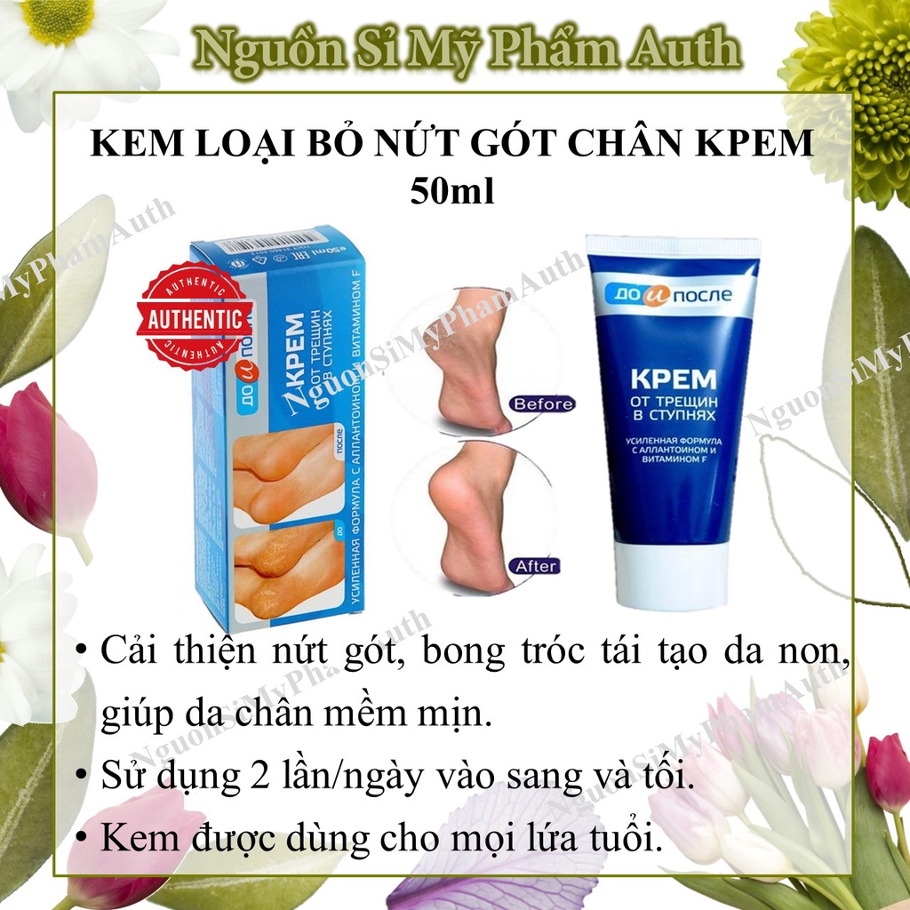 Kem nứt gót chân kpem Nga