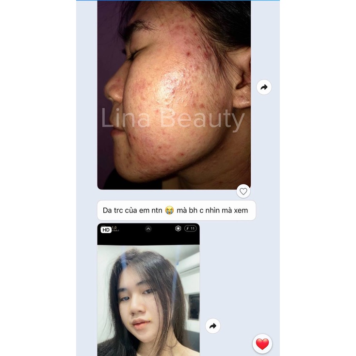 Serum giảm mụn mờ thâm Lina - Công dụng 3 trong 1 hiệu quả