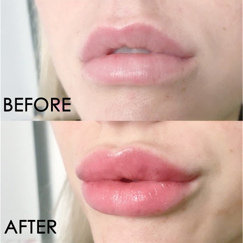 Dầu dưỡng môi Kiss Beauty trong suốt dưỡng ẩm dùng giảm nếp nhăn môi độc đáo