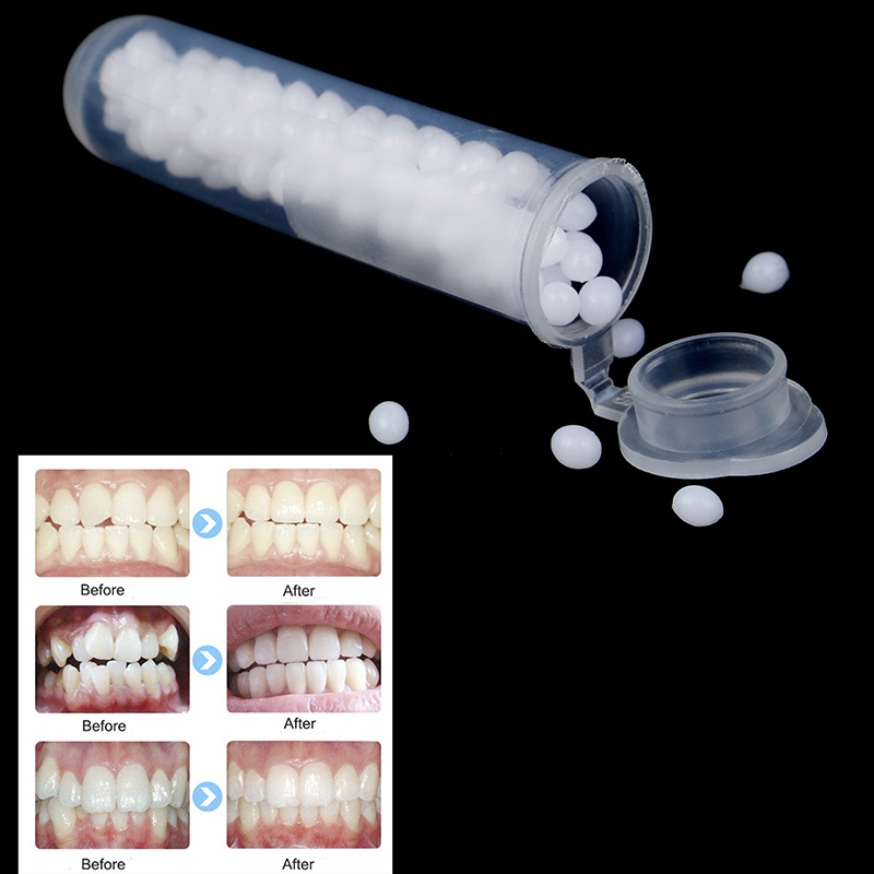 Keo Dán Sửa Chữa Răng Hư Hại Tạm Thời 1X