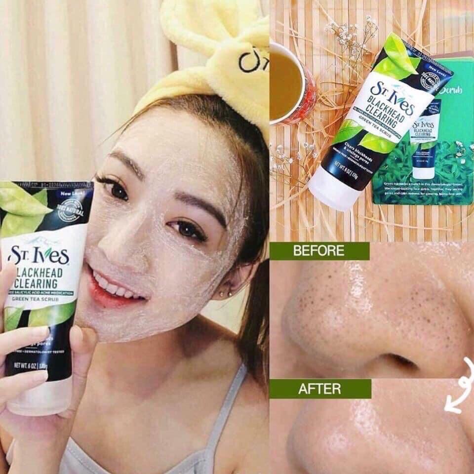 [Auth] Tẩy Da Chết Trà xanh Blackhead Clearing Green Tea Scrub St.Ives Mẫu Mới | BigBuy360 - bigbuy360.vn