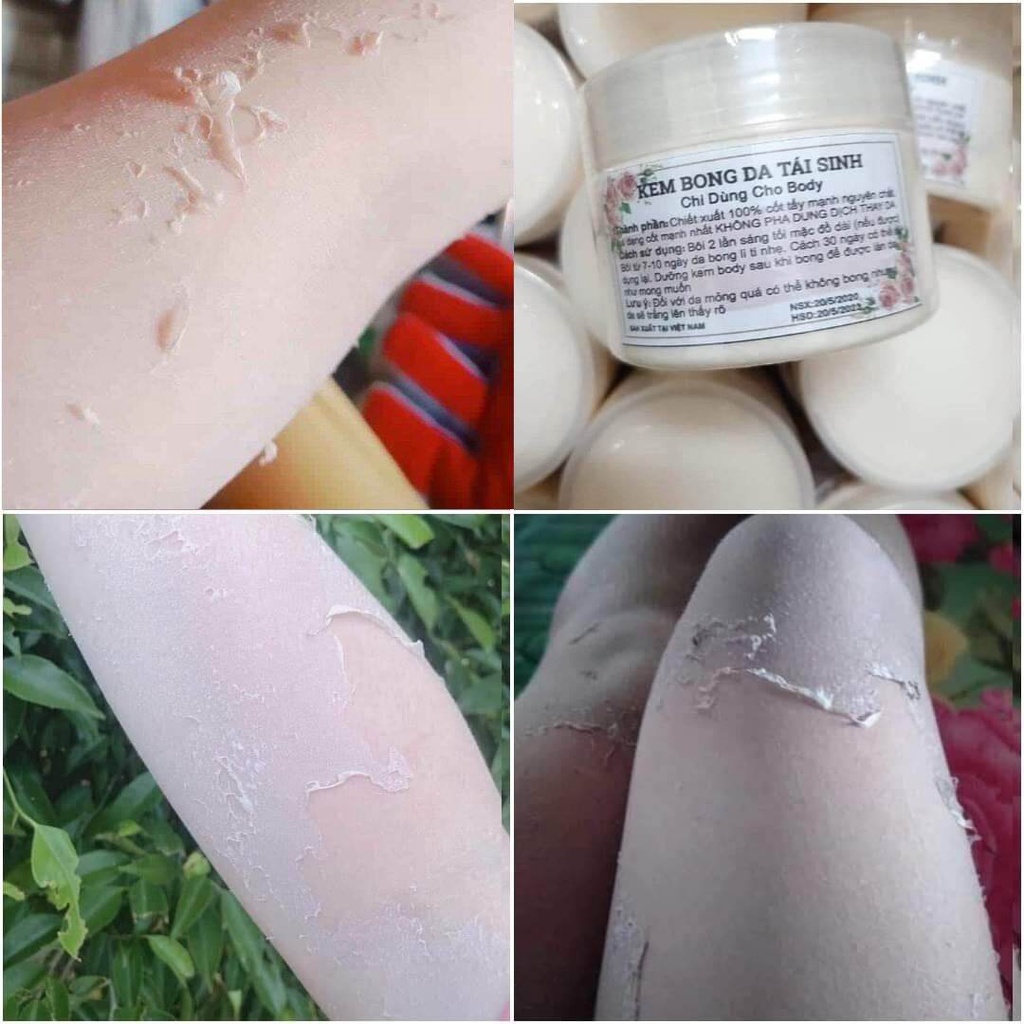 Kem bong da cốt đặc tái tạo body 150g - bong mảng to