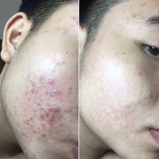 [SALE] bột diếp cá gói lớn