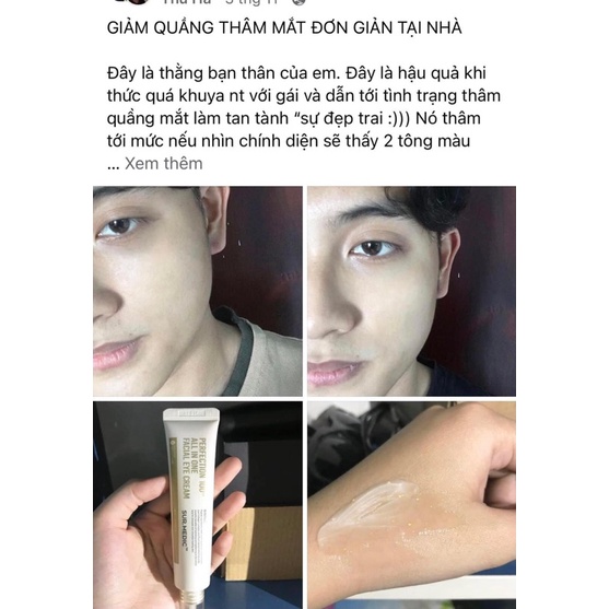 KEM GIẢM THÂM MẮT XOÁ MỜ NẾP NHĂN SURMEDIC PERFECTION 100TM