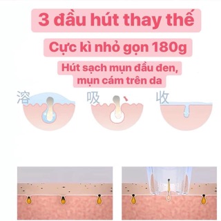 Máy hút mụn