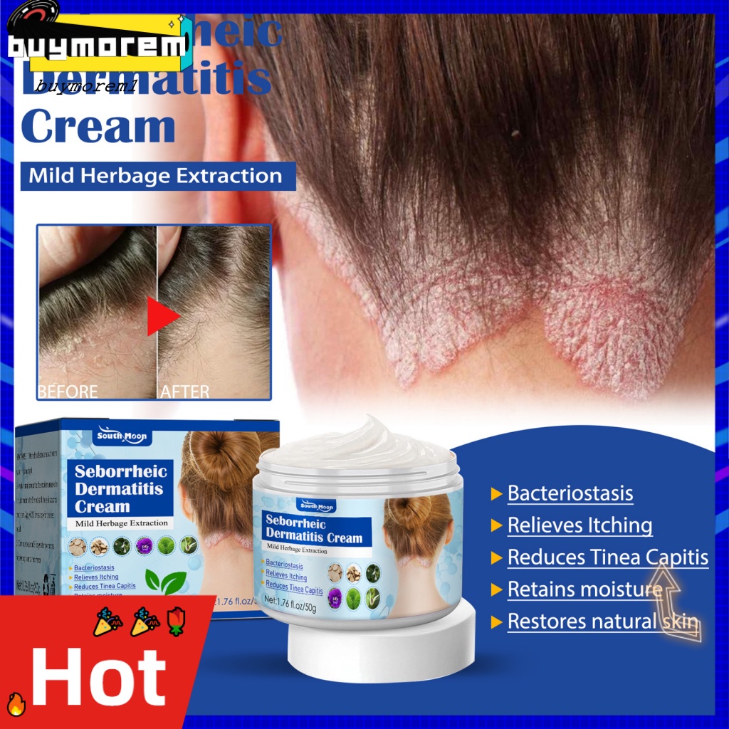 Kem Trị Ngứa Và Vẩy Nến Chàm Giúp Phục Hồi Da Đầu Hiệu Quả