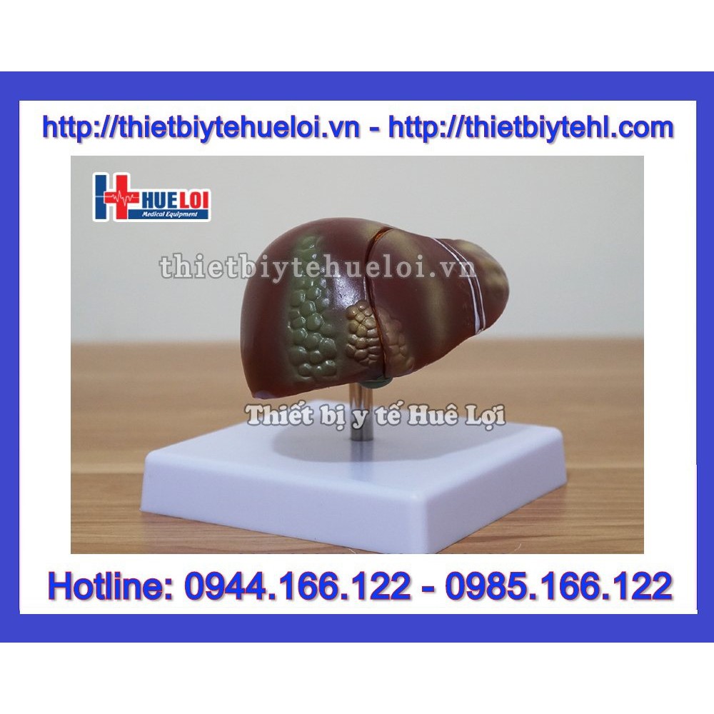 Mô hình tổng hợp bệnh lý gan