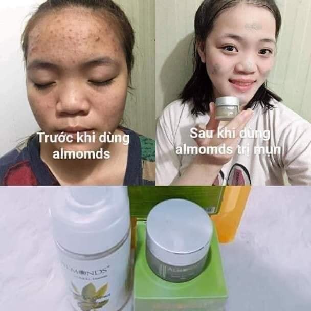 Cao mụn đông y Acnes Skin Care Almonds | BigBuy360 - bigbuy360.vn