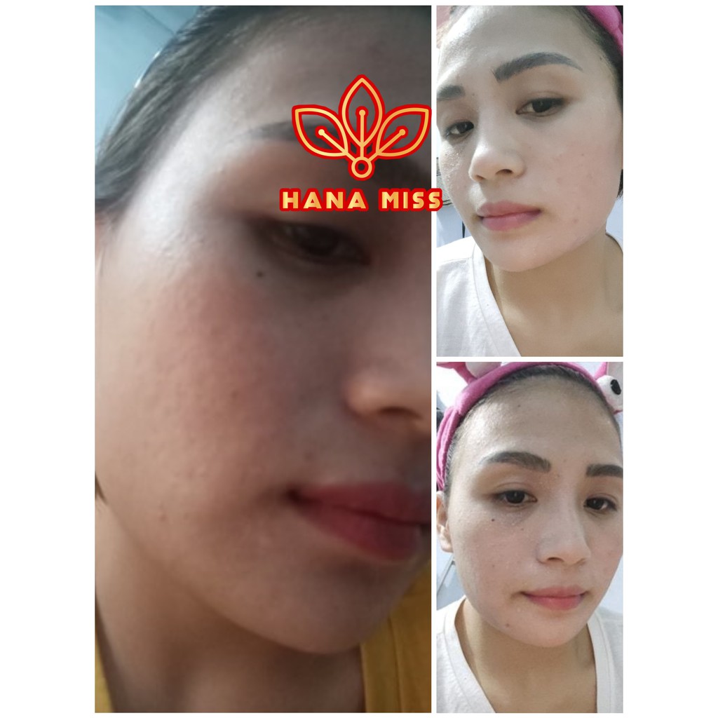 Kem Chống Lão Hóa Hana Miss Face Sakura