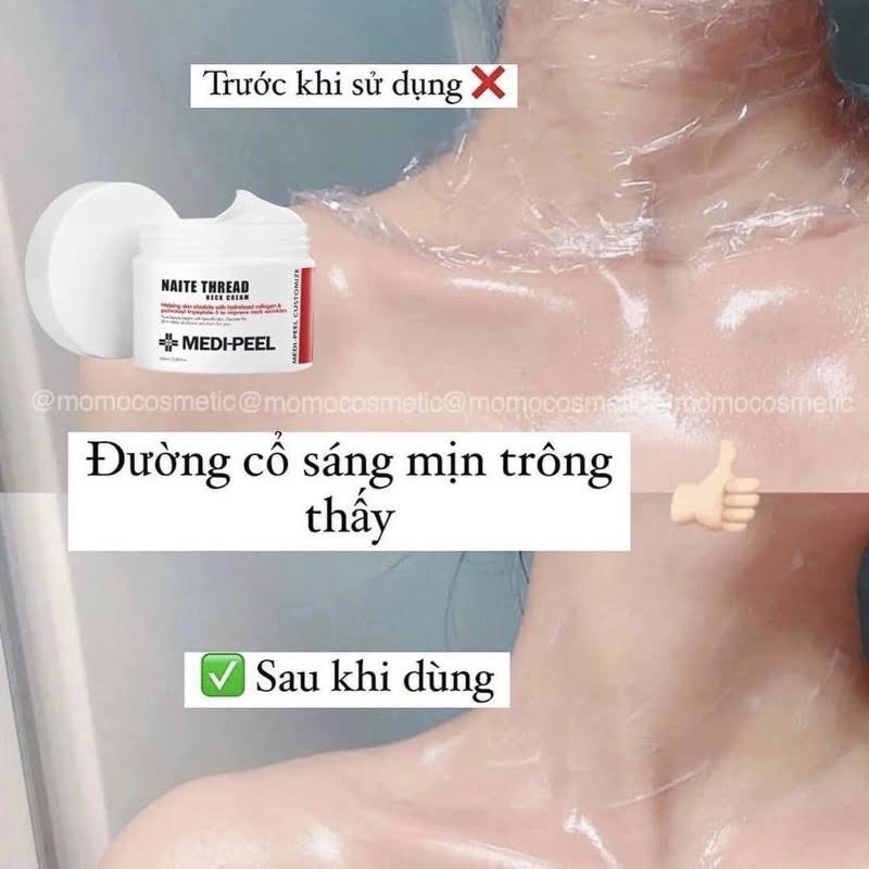 KEM DƯỠNG XOÁ NHĂN CỔ SỐ 1 HÀN QUỐC