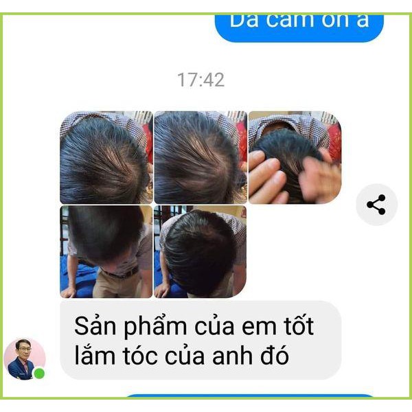 Dầu Gội Thảo Dược Comeon Hết Gàu - Giảm Rụng Tóc - Kích Thích Mọc Tóc - Chuẩn 100% | BigBuy360 - bigbuy360.vn