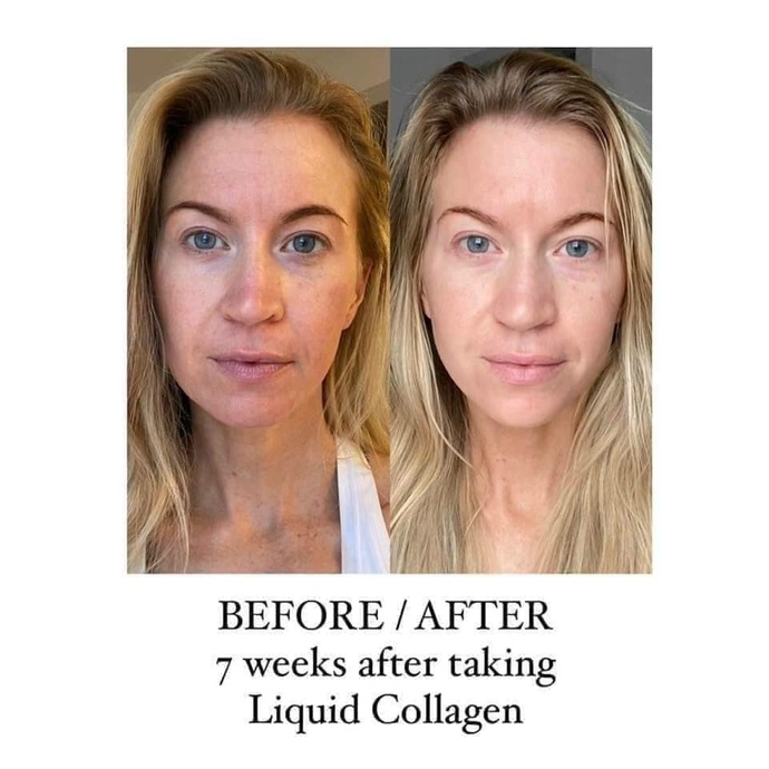 [APPLIED NUTRITION] Liquid Collagen Chống Lão Hóa Đẹp Da Của Mỹ