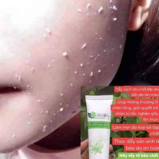 Tẩy tế bào chết Linh Hương