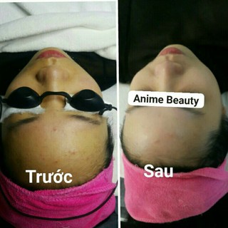 Mặt nạ ủ trắng da an toàn, hiệu quả