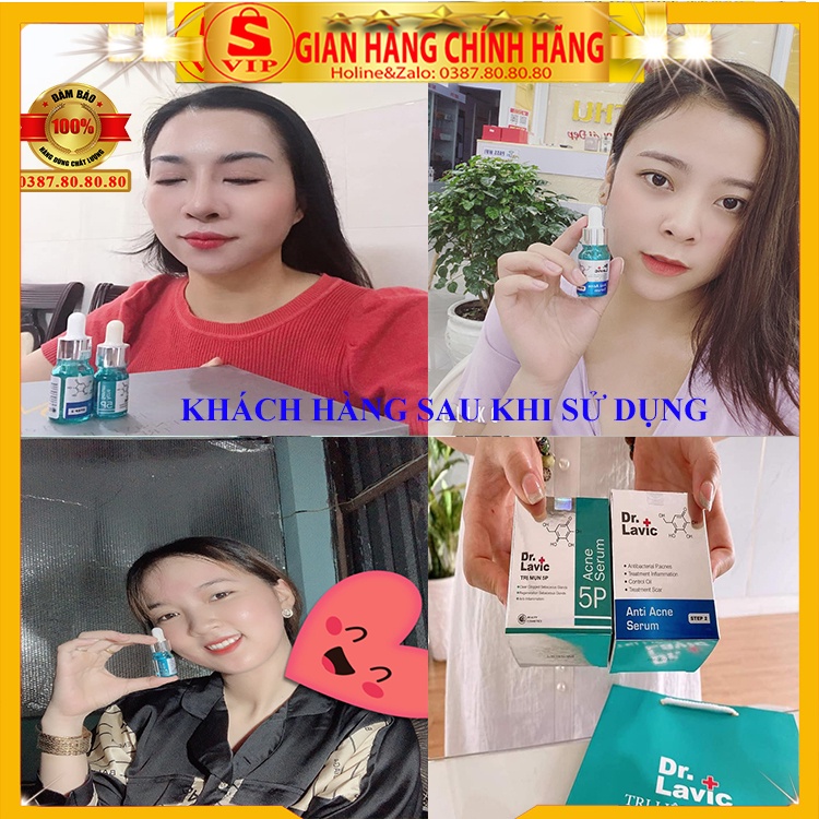 [ AUTH - HẾT MỤN HẾT THÂM ] Serum xóa mụn xóa thâm cao cấp Dr.Lavic hàn quốc/ Serum trij munj trắng da step 2 5k 5p xịn