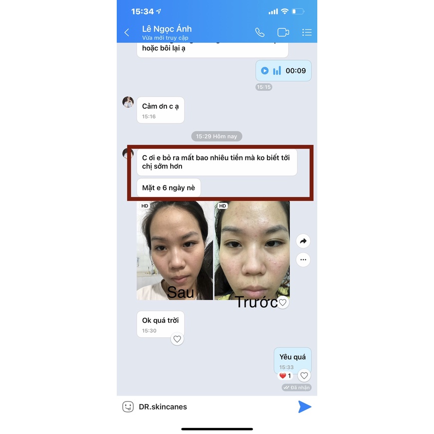 Serum mụn thảo dược Dr.Skin acnes, đánh bay mụn, sạch thâm trong 7 ngày | BigBuy360 - bigbuy360.vn