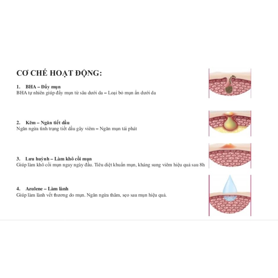 ACNES SPOT TREATMENT – Dung dịch chấm mụn