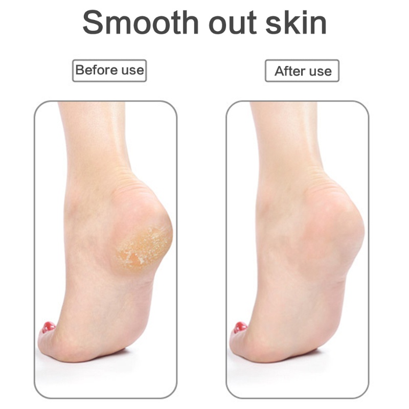 Đá Tẩy Tế Bào Chết Dành Cho Bàn Chân YOUYO