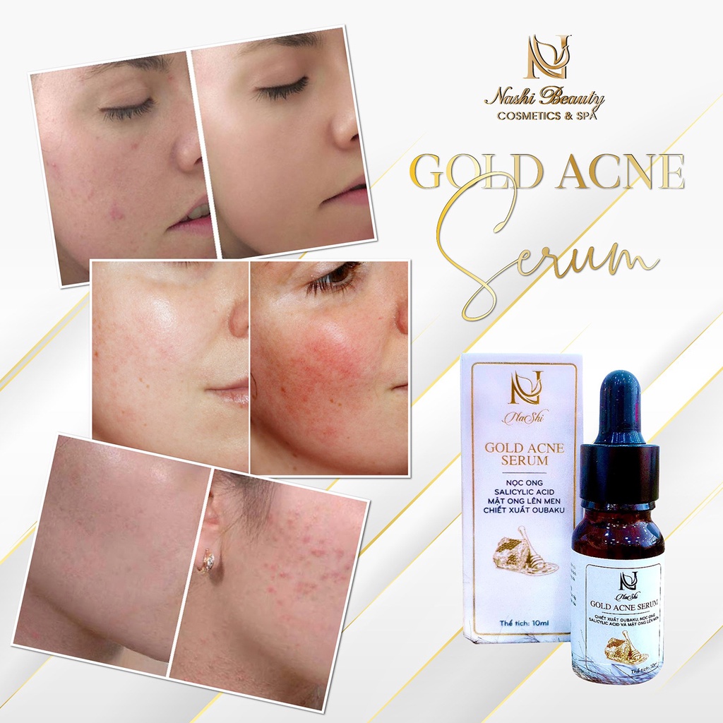 Serum Làm Giảm Mụn NASHI GOLD ACNE