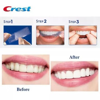 SET 48 MIẾNG DÁN TRẮNG RĂNG CREST 3D WHITE WHITESTRIPS