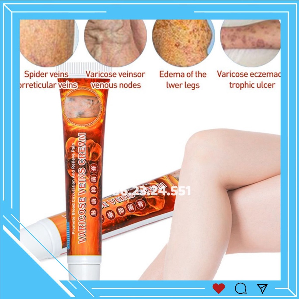 Kem bôi suy giãn tĩnh mạch 20gr
