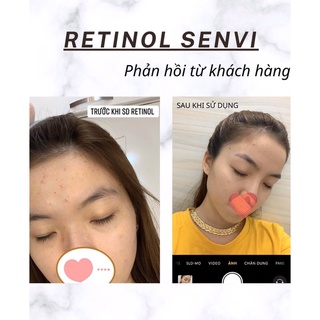 Retinol senvi