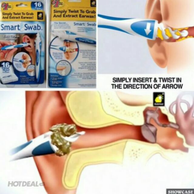 Dụng cụ lấy ráy tai