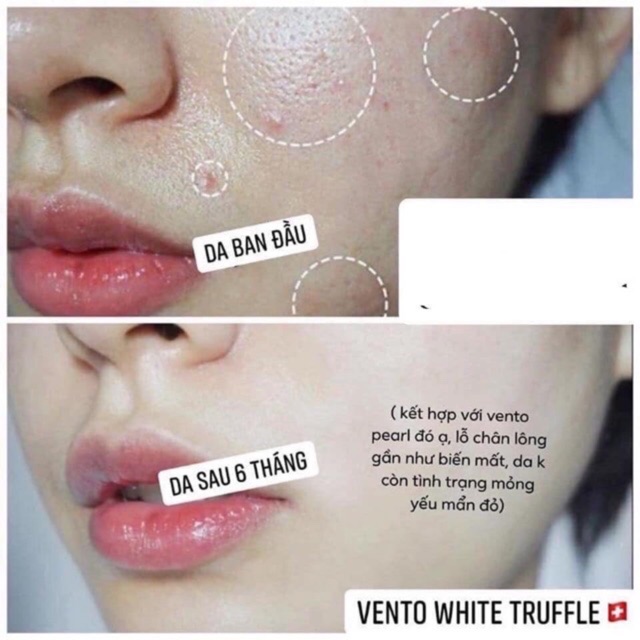 Kem Dưỡng Da Vento Vivere White Thuỵ Sĩ