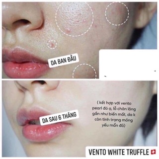 [bao hoang]  Kem Dưỡng Da Vento Vivere White Thuỵ Sĩ