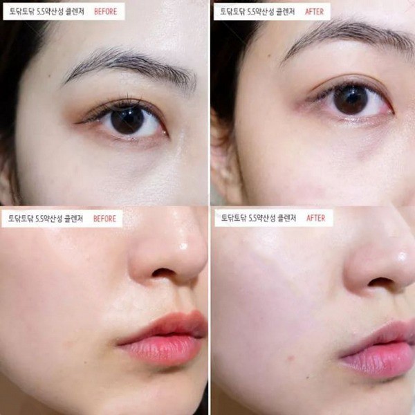 Sữa Rửa Mặt La Roche Dạng Gel Dành Cho Da Dầu Nhạy Cảm Giúp Làm Sạch Bã Nhờn 400ML