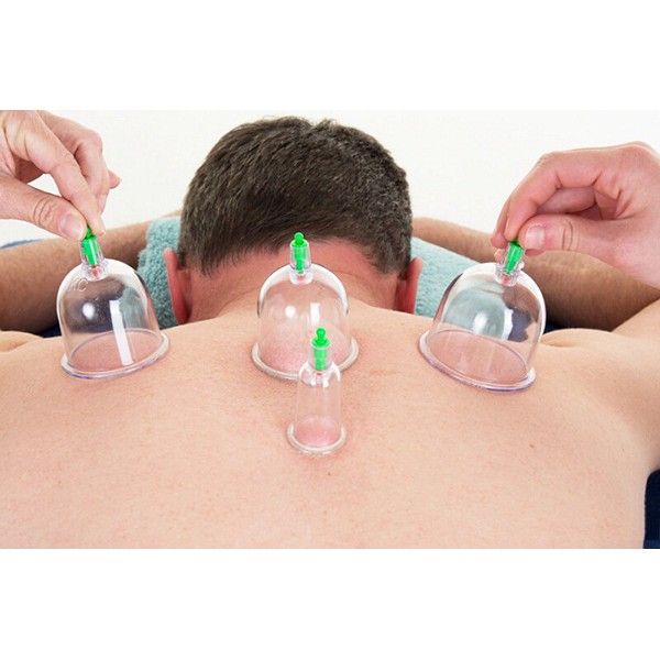 Bộ Giác Hơi Không Cần Lửa 12 Ly