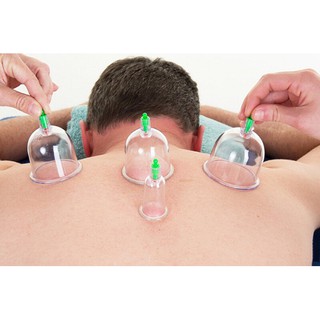 Bộ Giác Hơi Không Cần Lửa 12 Ly