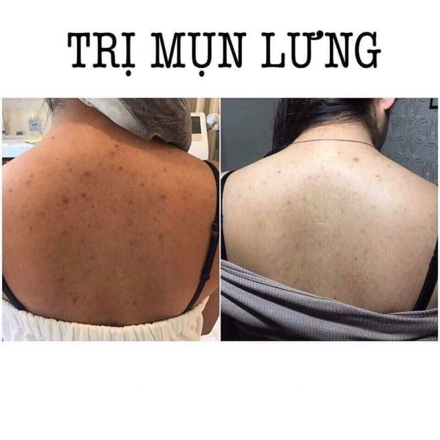 Xà Bông Cho Lưng For Back Nhật Bản