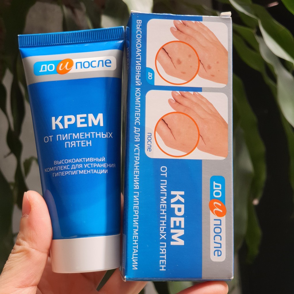 Kem Nám Tay Kpem Nga 45ml Kem Giảm Đốm Nâu Tay Đồi Mồi