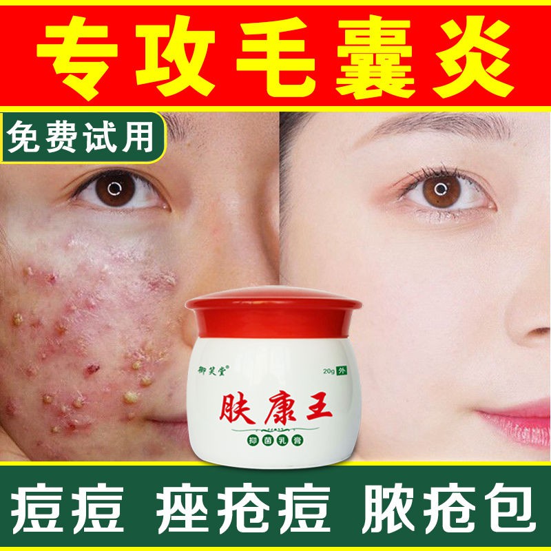 (Hàng Mới Về) Bộ Sản Phẩm Trị Mụn Đầu Đen Liposomes