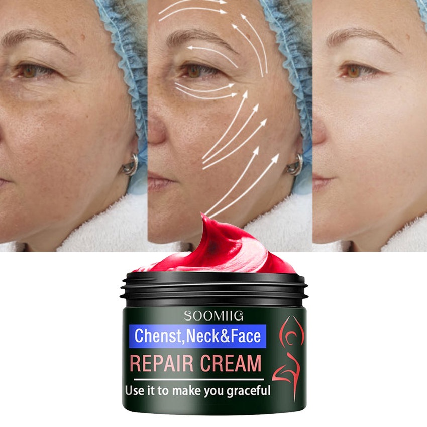 Kem Collagen Làm Trắng Da Mặt Chống Nếp Nhăn Và Làm Săn Chắc Da