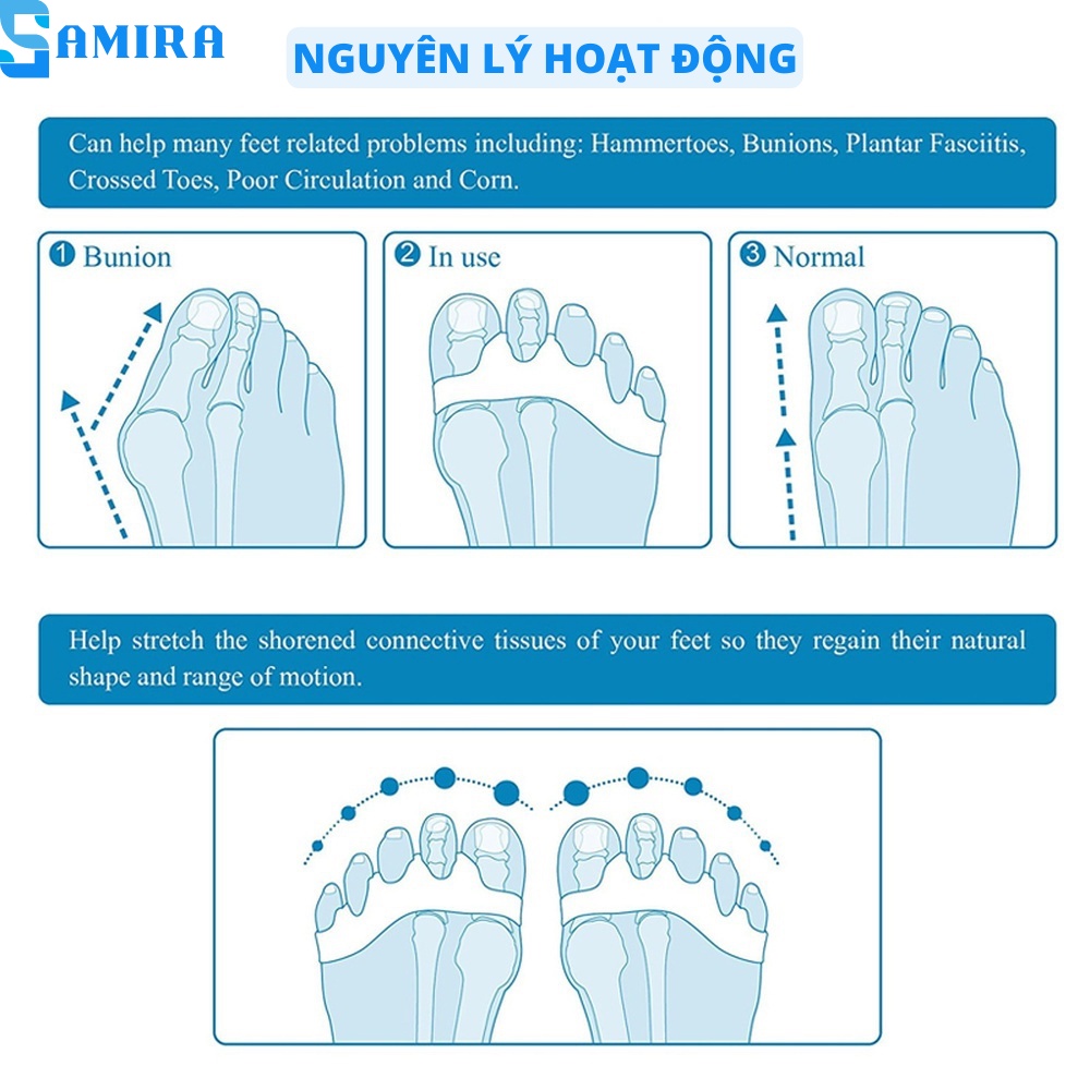 Dụng cụ silicon tách ngón chân giảm đau chỉnh hình ngón chân cái siêu bền cao cấp SA14