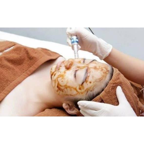 Hồng Sâm GOGO Cấy Sáng Da, Mờ Thâm, Cấy Hồng Sâm Nano Baby