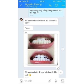[Sốc] Máy trắng răng cao cấp Nhật Bản